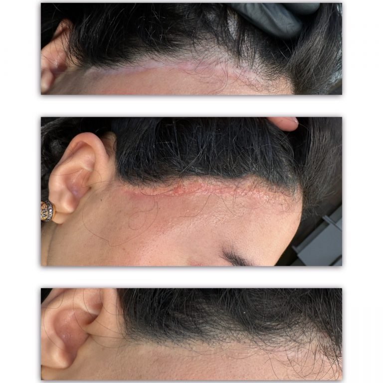 Scar Camouflage e1738146991437