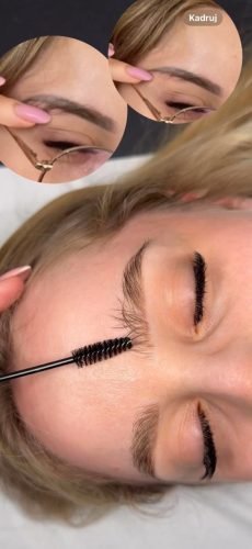 Eyebrow Laser Removal